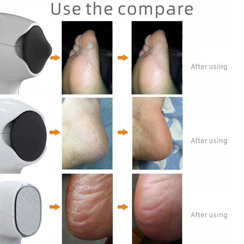 2022 НОВЫЕ Инструменты Для Педикюра Nanoglass Skin Care Электрическая Пилочка Для Ног Для Удаления Омертвевшей Кожи И Мозолей USB-Шлифовальная Машина Для Ног Инструмент Для Ухода За ногами - 3