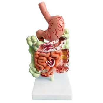 Модель пищеварительной системы человека, Анатомия желудка, Кишечника, Слепой кишки, прямой кишки, Двенадцатиперстной кишки, Модель Строения внутренних органов человека