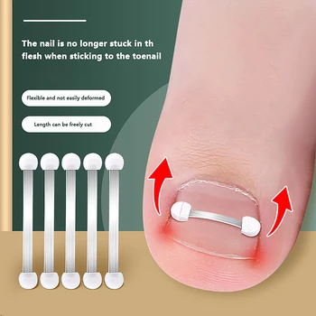 Корректор Вросшего Ногтя На Ноге Ортодонтический Педикюр Recover Embedded Toe Nail Treatment Pro Коррекция Вросшего Ногтя На Ноге Пластырь Для Ногтей На Ногах